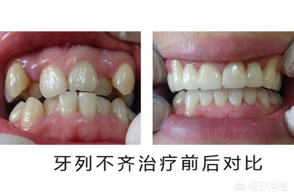 楚雄最新24小时牙医在线咨询方法分析(最方便真实的楚雄有没有24小时牙医方法)