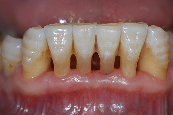 楚雄最新24小时牙医在线咨询方法分析(最方便真实的楚雄有没有24小时牙医方法)